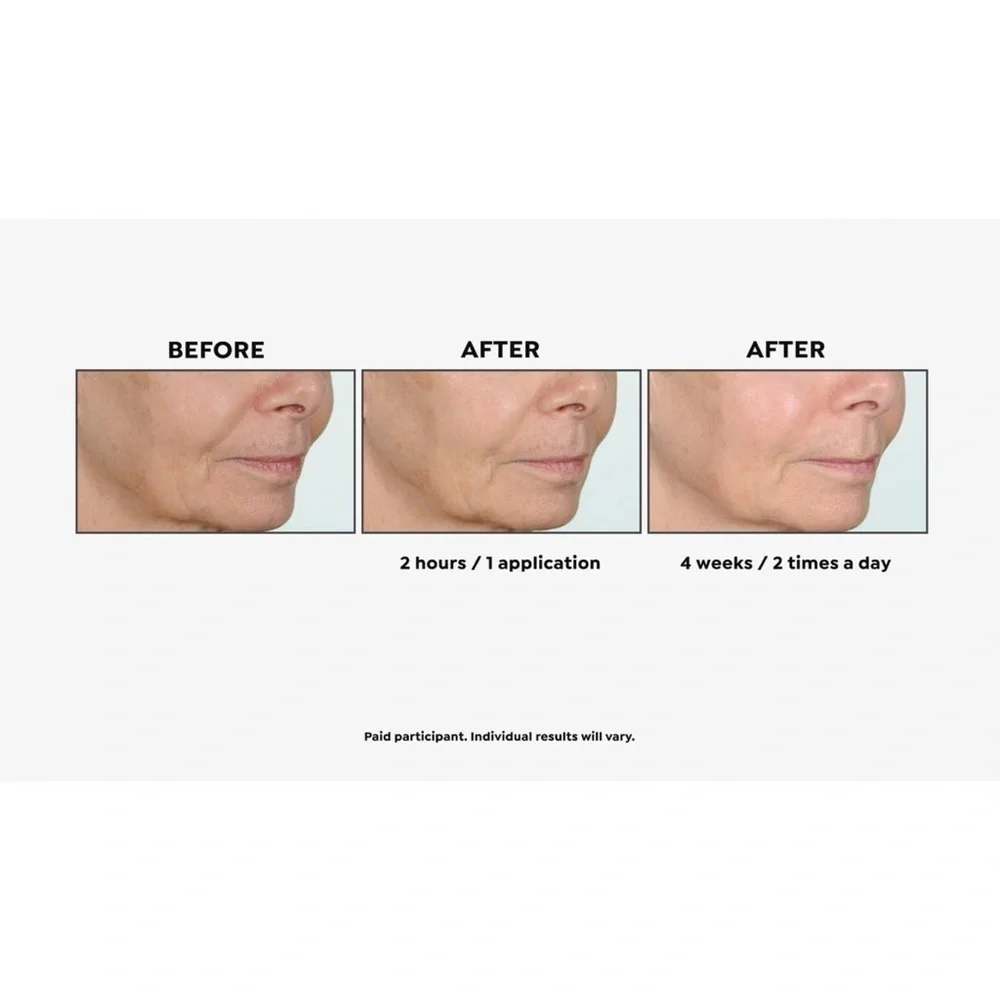 Perlier Black Rice Triple Size Hyaluronic Gel & Eye‎ Serum Auto-Ship®